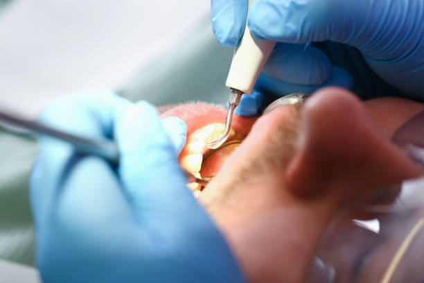 Best Emergency Treatment for Dental Infections or Abscesses in Evergreen, AL